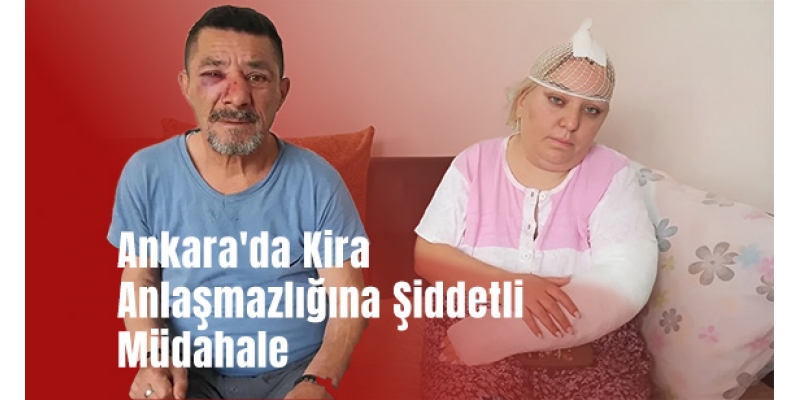 Ankara'da Kira Anlaşmazlığına Şiddetli Müdahale: Ev Sahibi Tutuklandı